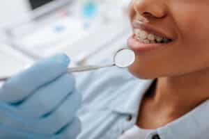 Orthodontic Options for Adults in Chandler TX